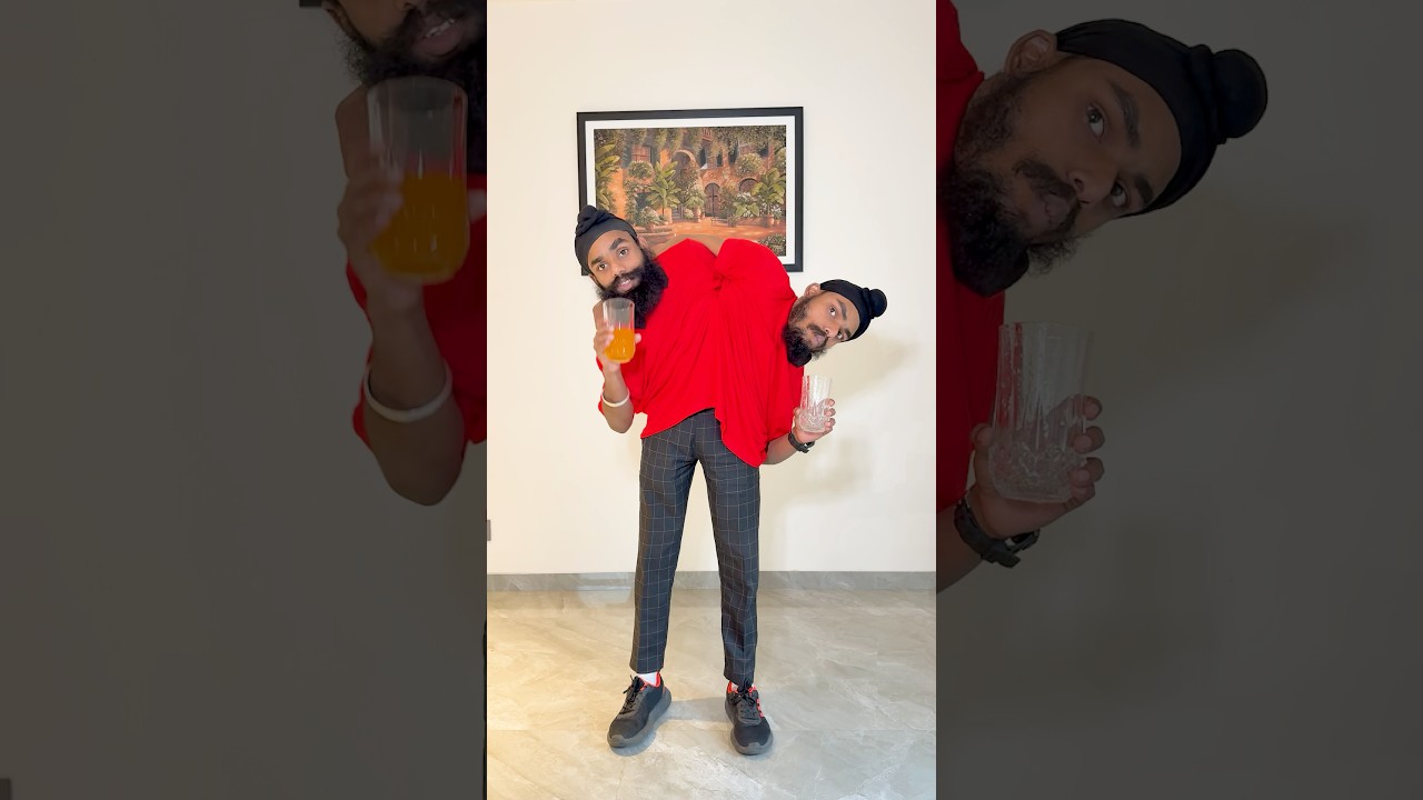 CONJOINED TWINS!