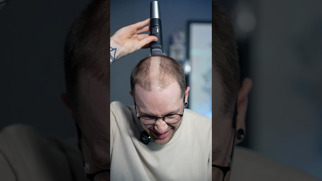 I Deleted My Hair…