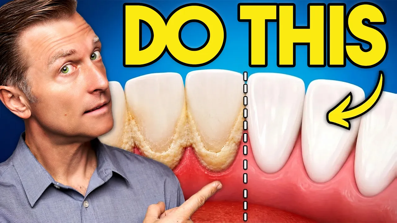 The #1 Way to Stop Tartar From Coming Back for Good