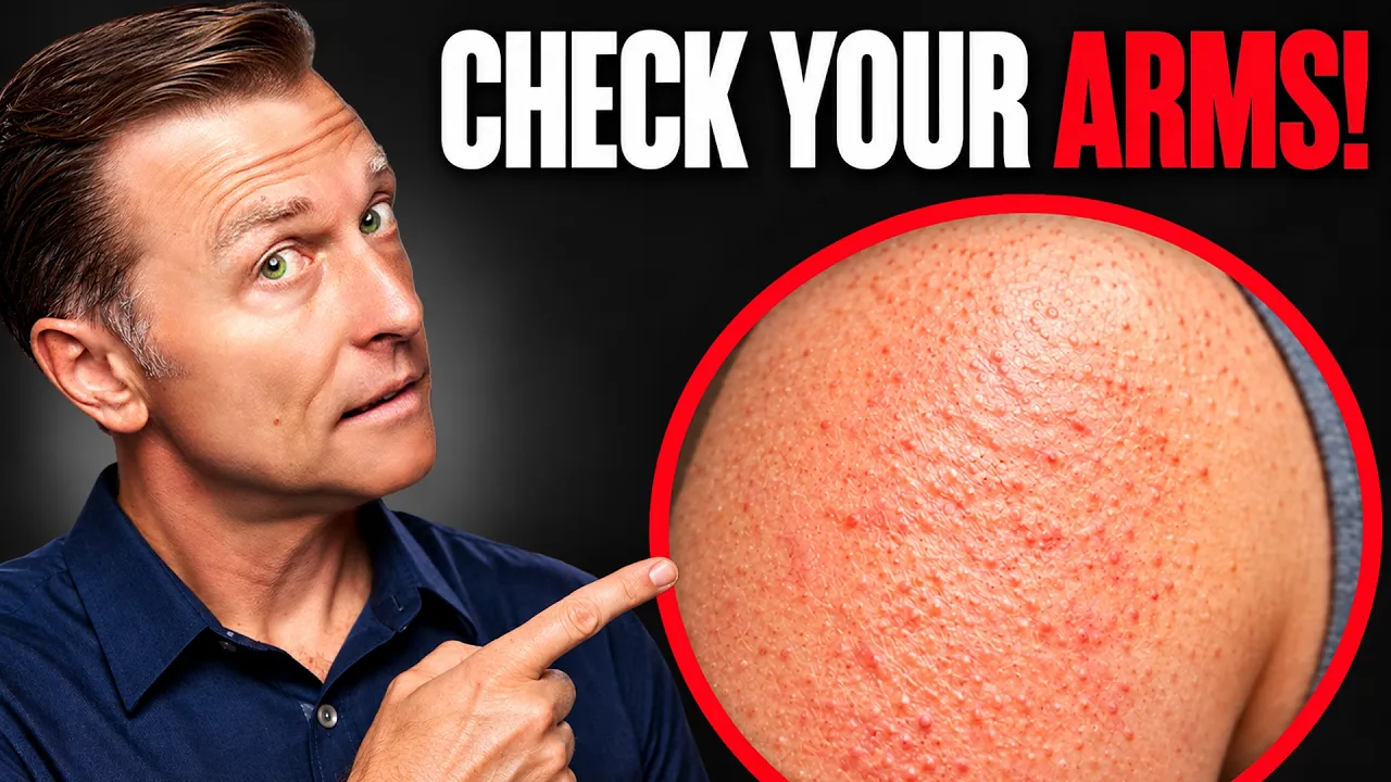 The One Deficiency Behind Dry Eyes, Dry Mouth, and Bumpy Arms