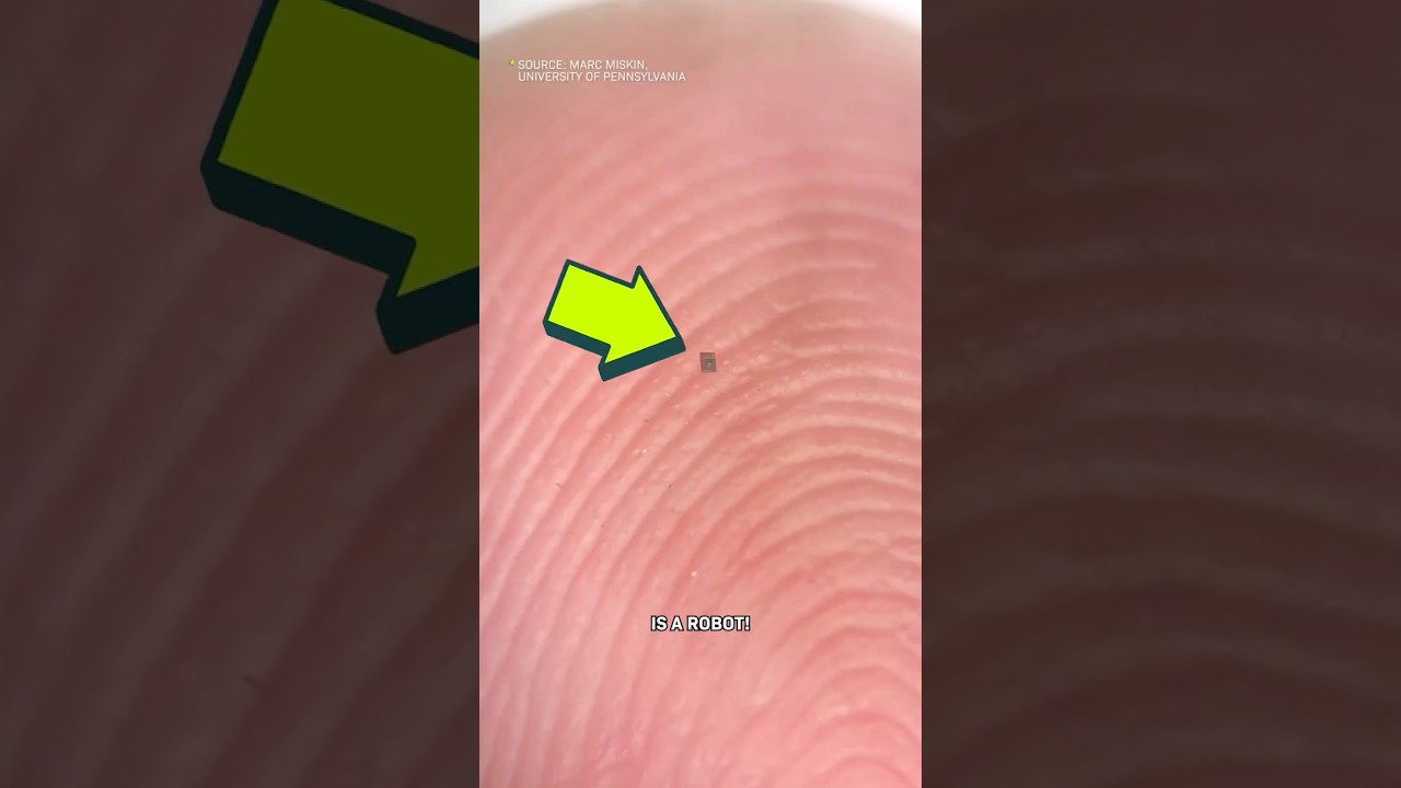 This Microrobot Wiggles In Your Body