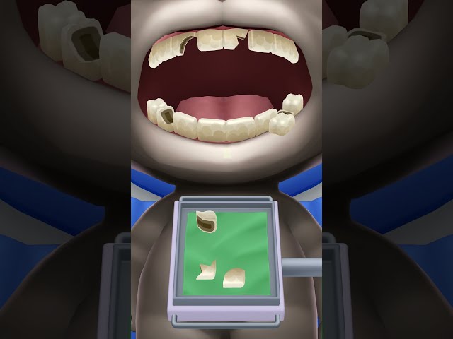 today i am a dentist and my patient is vibes 🪥#MyTalkingTom2 #ToothbrushTime #DentistMode