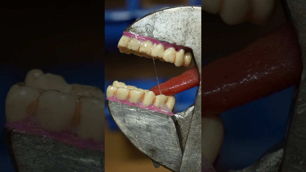 tooth wrench
